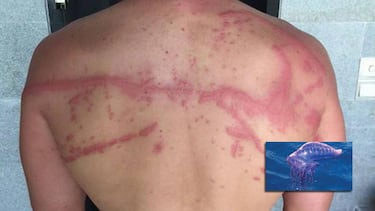 Alerta en las playas de Espa?a por la carabela portuguesa: estas son las afectadas