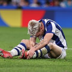 Peligra Oskarsson para el Real Madrid: lesión en el recto anterior de su pierna izquierda