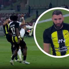 La cara de Benzema es un poema: no hay acción que defina mejor su periplo en Arabia