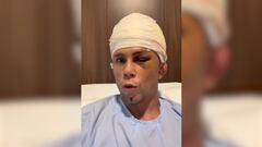 Agredido brutalmente por su ex equipo: su vuelta a la UFC en duda