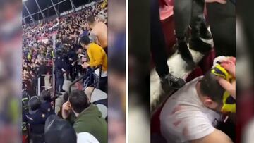 La Policía Nacional deja de esta guisa a un aficionado en Sevilla con sus porras