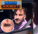 El Chiringuito muestra el ojo y el pómulo de Baena cinco días después del puñetazo