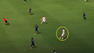 Xabi atrae al bisturí