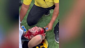 La salvajada que se vivió en Maracaná, desde dentro: la cara de Messi, un poema