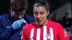 El penalti no pitado a Sheila en el Atleti-Madrid por un codazo que le ha dejado el ojo de esta guisa