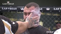 La peor que se recuerda: le desfigura la cara por completo, impacta ver el resultado...