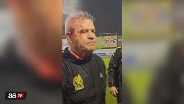 Tras ser descalabrado, Javier Aguirre recibó insultos y más agresiones rumbo al vestidor