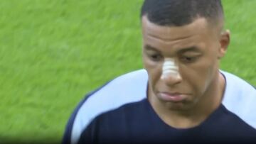Mbappé trains alone with visible concern following nose injury in first post-incident video