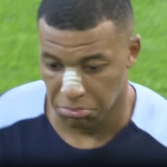 Mbappé trains alone with visible concern following nose injury in first post-incident video