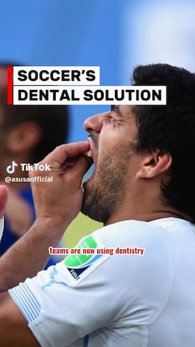 Real Madrid’s Camavinga sidelined by dental issue that can increase injury risk