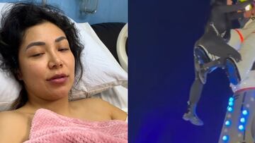 Brutal accidente en el EDC provoca que una mujer sea operada de emergencia