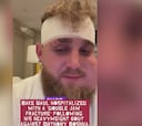 La imagen es escalofriante: Jake Paul reaparece en redes tras la pelea y el vídeo suma ya 5M de visitas