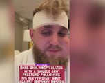 La imagen es escalofriante: Jake Paul reaparece en redes tras la pelea y el vídeo suma ya 5M de visitas