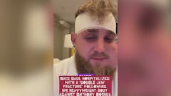 La imagen es escalofriante: Jake Paul reaparece en redes tras la pelea y el vídeo suma ya 5M de visitas