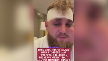 La imagen es escalofriante: Jake Paul reaparece en redes tras la pelea y el vídeo suma ya 5M de visitas