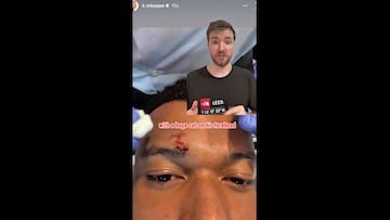 Mbappé is ready: Real Madrid injury report for Bayern Munich second leg