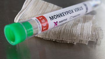 Los casos de viruela de mono han aumentado significativamente en el estado de Nueva York. ¿A qué se debe esto y qué medidas habrá?