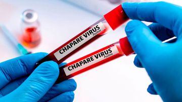 Virus Chapare: ¿qué se sabe del virus que fue detectado en Bolivia?