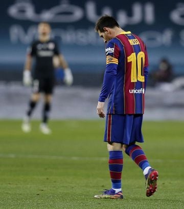 Corría el minuto 120’ cuando el astro argentino golpeó con el brazo derecho a Villalibre del Athletic. Messi dejó ver su frustración pues estaban a solo unos minutos de perder la final y esto se consumó instantes más tarde.