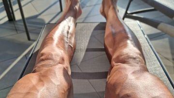 Así lucen las piernas de Ibrahimovic tras su lesión