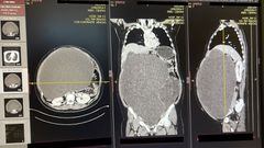Radiografía tumor abdominal 20kg