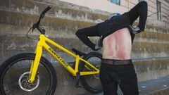El piloto de MTB Danny MacAskill, frente a su bici Santa Cruz de Street Trial, se levanta el jersey para mostrar su espalda llena de rascadas y roja durante la grabaci&oacute;n de su v&iacute;deo Postal desde San Francisco. 